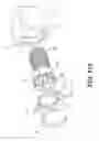 Fig. 80 - Expandable fusion device and method of installation thereof