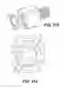 Fig. 85 - Expandable fusion device and method of installation thereof