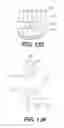 Fig. 94 - Expandable fusion device and method of installation thereof