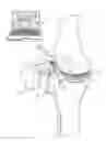 Fig. 01 - Surgical apparatus to support installation of a prosthetic component and method therefore