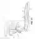 Fig. 07 - Surgical apparatus to support installation of a prosthetic component and method therefore