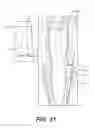 Fig. 20 - Surgical apparatus to support installation of a prosthetic component and method therefore