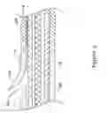 Fig. 05 - Rapid exchange stent delivery system