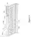 Fig. 07 - Rapid exchange stent delivery system