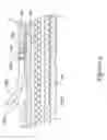 Fig. 10 - Rapid exchange stent delivery system