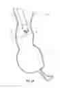 Fig. 06 - Obesity treatment devices, systems, and methods