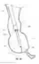 Fig. 07 - Obesity treatment devices, systems, and methods