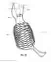 Fig. 09 - Obesity treatment devices, systems, and methods