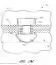 Fig. 40 - Controlled drug delivery ocular implants and methods of using same