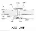 Fig. 49 - Controlled drug delivery ocular implants and methods of using same