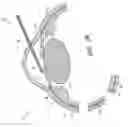Fig. 65 - Controlled drug delivery ocular implants and methods of using same