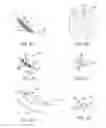 Fig. 41 - Ocular insert apparatus and methods