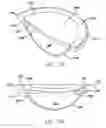 Fig. 09 - METHOD AND SYSTEM FOR ADJUSTING THE REFRACTIVE POWER OF AN IMPLANTED INTRAOCULAR LENS