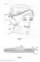 Fig. 02 - SOUND MUFFLING HEADWEAR