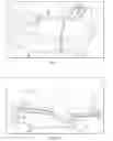 Fig. 02 - Total contact cast system and methods for safe and easy removal thereof