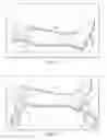 Fig. 04 - Total contact cast system and methods for safe and easy removal thereof