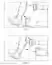 Fig. 05 - Total contact cast system and methods for safe and easy removal thereof