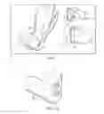 Fig. 06 - Total contact cast system and methods for safe and easy removal thereof
