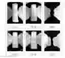 Fig. 04 - DISPOSABLE ABSORBENT ARTICLE HAVING UNDERGARMENT FASTENING ELEMENTS