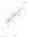 Fig. 07 - Variable speed patient transfer apparatus
