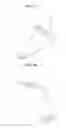 Fig. 02 - MOTION ASSISTANCE APPARATUS