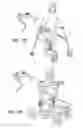 Fig. 24 - DEVICES ENABLING THE DISABLED TO STAND, WALK AND ACTIVATE ONE'S BODY