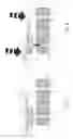 Fig. 07 - Cushion structure for massager movement touch switch