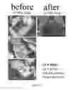 Fig. 28 - Pharmaceutical suspensions containing drug particles, devices for their administration, and methods of their use