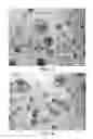 Fig. 02 - Dosage form comprising an active ingredient and a plurality of solid porous microcarriers