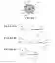 Fig. 02 - MULTIFUNCTIONAL MICELLAR NANOPARTICLE-BASED DRUG AND TARGETING AGENT SYSTEM
