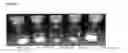 Fig. 17 - Anti-CD3 antibody formulations