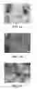 Fig. 02 - Compositions of nucleic acid-containing nanoparticles for in vivo delivery