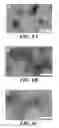 Fig. 07 - Compositions of nucleic acid-containing nanoparticles for in vivo delivery