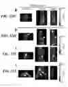 Fig. 33 - Compositions of nucleic acid-containing nanoparticles for in vivo delivery