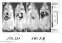 Fig. 35 - Compositions of nucleic acid-containing nanoparticles for in vivo delivery