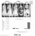 Fig. 36 - Compositions of nucleic acid-containing nanoparticles for in vivo delivery