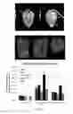 Fig. 03 - EVALUATION OF PRESENCE OF AND VULNERABILITY TO ATRIAL FIBRILLATION AND OTHER INDICATIONS USING MATRIX METALLOPROTEINASE-BASED IMAGING