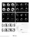 Fig. 05 - EVALUATION OF PRESENCE OF AND VULNERABILITY TO ATRIAL FIBRILLATION AND OTHER INDICATIONS USING MATRIX METALLOPROTEINASE-BASED IMAGING