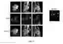 Fig. 08 - EVALUATION OF PRESENCE OF AND VULNERABILITY TO ATRIAL FIBRILLATION AND OTHER INDICATIONS USING MATRIX METALLOPROTEINASE-BASED IMAGING