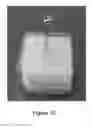 Fig. 03 - INJECTABLE BONE SUBSTITUTES FOR AUGMENTING IMPLANT FIXATION