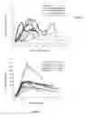 Fig. 06 - INJECTABLE BONE SUBSTITUTES FOR AUGMENTING IMPLANT FIXATION