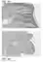 Fig. 06 - Human nipple areolar complex extracellular matrix scaffold and methods relating thereto