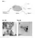 Fig. 02 - Light adjustable intraocular lenses using upconverting nanoparticles and near infrared (NIR) light