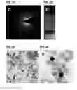 Fig. 03 - Light adjustable intraocular lenses using upconverting nanoparticles and near infrared (NIR) light