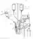 Fig. 01 - Catheter pump with positioning brace