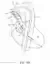 Fig. 22 - Catheter pump with positioning brace