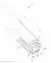 Fig. 01 - Method and apparatus for the dialysis of blood