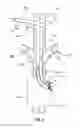 Fig. 05 - Method and apparatus for the dialysis of blood