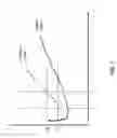 Fig. 04 - Motorized catheter system with improved inflation control