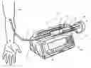 Fig. 01 - Force sensing devices, systems and methods for syringe pumps